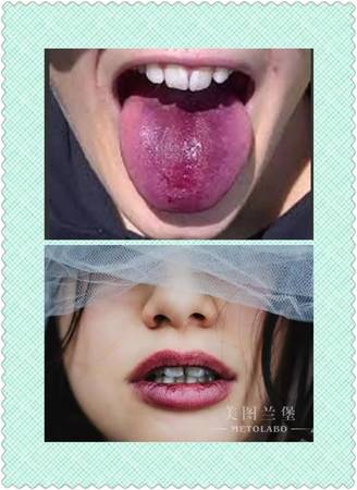 葡萄酒喝后嘴唇发黑(葡萄酒喝了后嘴唇发黑)